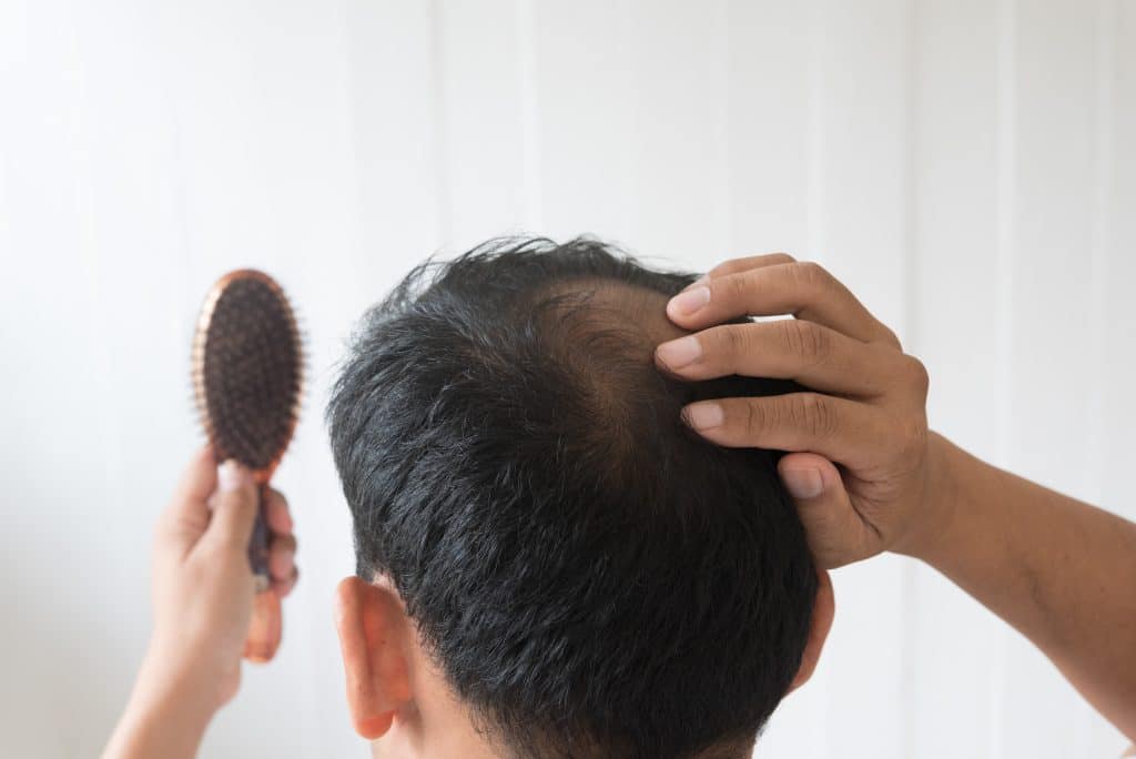 combattre chute cheveux homme