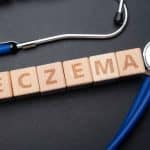 Comment traiter l’eczéma du cuir chevelu chez l’homme ?
