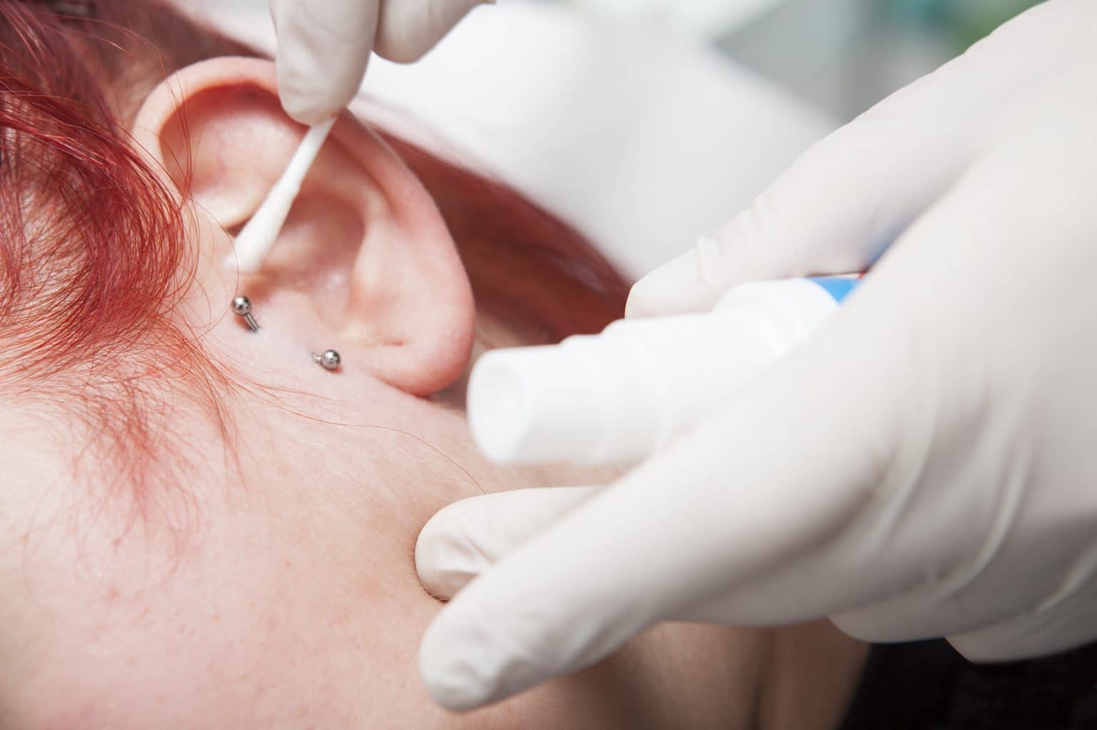 Un Dermato Peut Il Reboucher Un Piercing